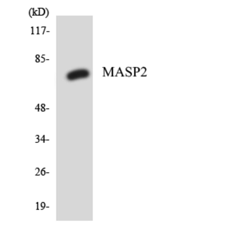 Western Blot - Anti-MASP2 Antibody (R12-2999) - Antibodies.com