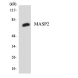 Western Blot - Anti-MASP2 Antibody (R12-2999) - Antibodies.com