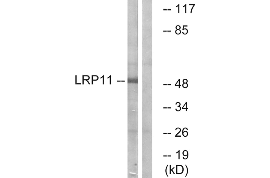 Western Blot - Anti-LRP11 Antibody (C16508) - Antibodies.com