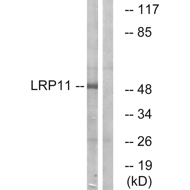 Western Blot - Anti-LRP11 Antibody (C16508) - Antibodies.com