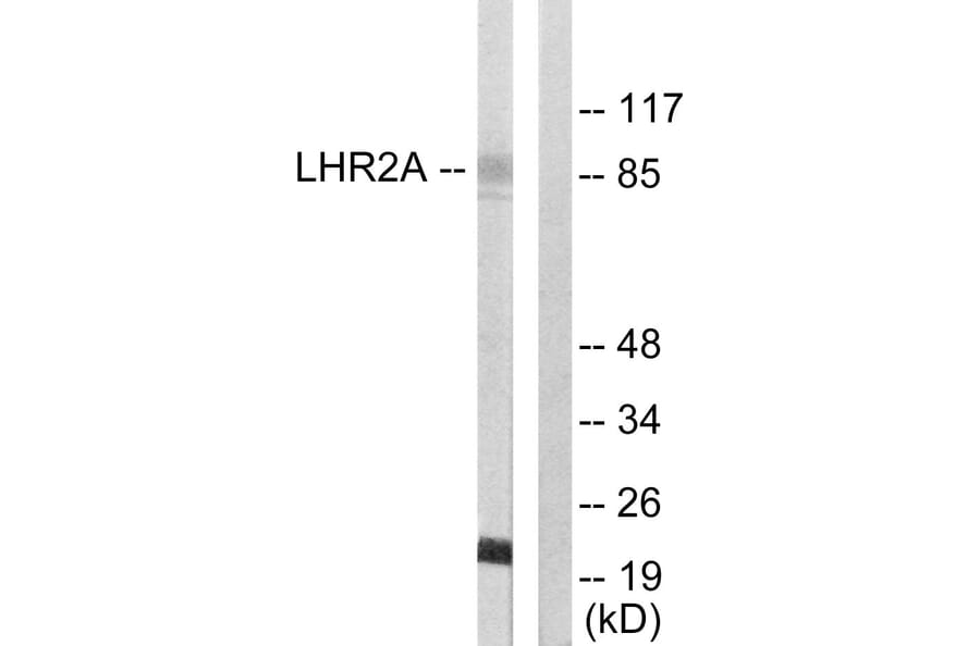 Western Blot - Anti-LHR2A Antibody (C10028) - Antibodies.com