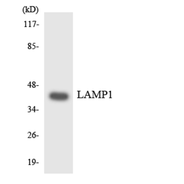 Western Blot - Anti-LAMP1 Antibody (R12-2961) - Antibodies.com