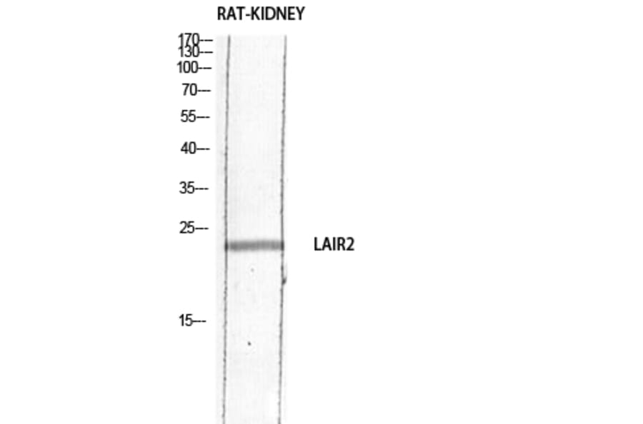 Western Blot - Anti-LAIR2 Antibody (C30555) - Antibodies.com