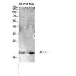 Western Blot - Anti-LAIR2 Antibody (C30555) - Antibodies.com