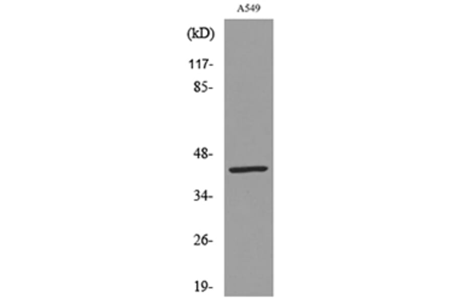 Western Blot - Anti-KRT19 Antibody (C30014) - Antibodies.com