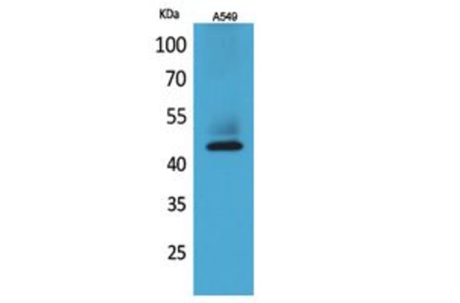 Western Blot - Anti-KRT19 Antibody (C30014) - Antibodies.com