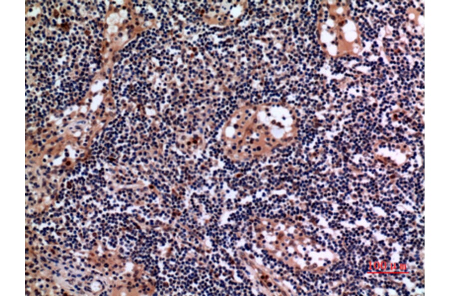Immunohistochemistry - Anti-KRT19 Antibody (C30014) - Antibodies.com