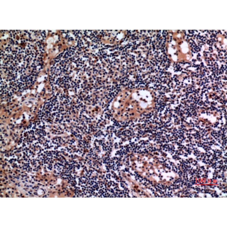 Immunohistochemistry - Anti-KRT19 Antibody (C30014) - Antibodies.com