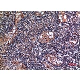 Immunohistochemistry - Anti-KRT19 Antibody (C30014) - Antibodies.com