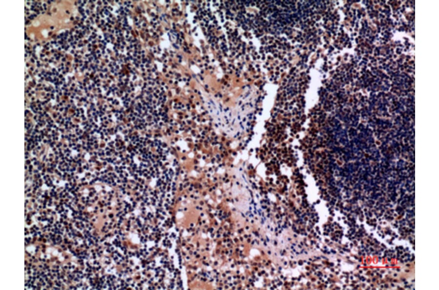 Immunohistochemistry - Anti-KRT19 Antibody (C30014) - Antibodies.com