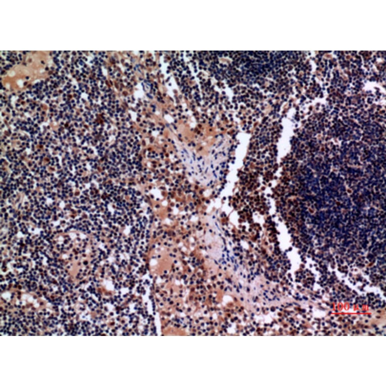 Immunohistochemistry - Anti-KRT19 Antibody (C30014) - Antibodies.com