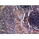 Immunohistochemistry - Anti-KRT19 Antibody (C30014) - Antibodies.com