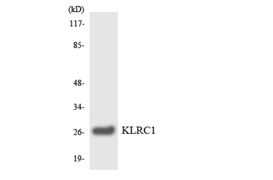 Western Blot - Anti-KLRC1 Antibody (R12-2957) - Antibodies.com