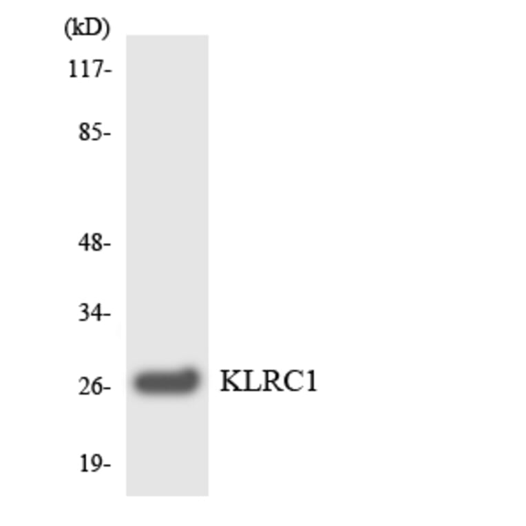 Western Blot - Anti-KLRC1 Antibody (R12-2957) - Antibodies.com