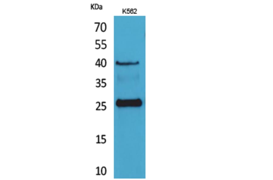 Western Blot - Anti-KLRB1 Antibody (C30502) - Antibodies.com