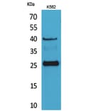 Western Blot - Anti-KLRB1 Antibody (C30502) - Antibodies.com