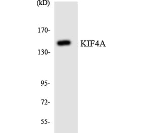 Western Blot - Anti-KIF4A Antibody (R12-2952) - Antibodies.com