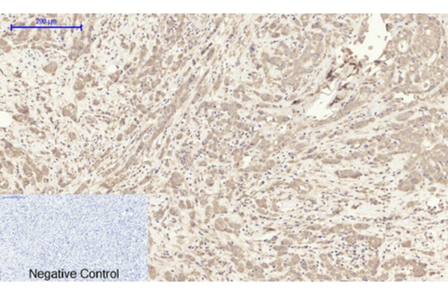 Immunohistochemistry - Anti-ITGB3 Antibody (C30370) - Antibodies.com
