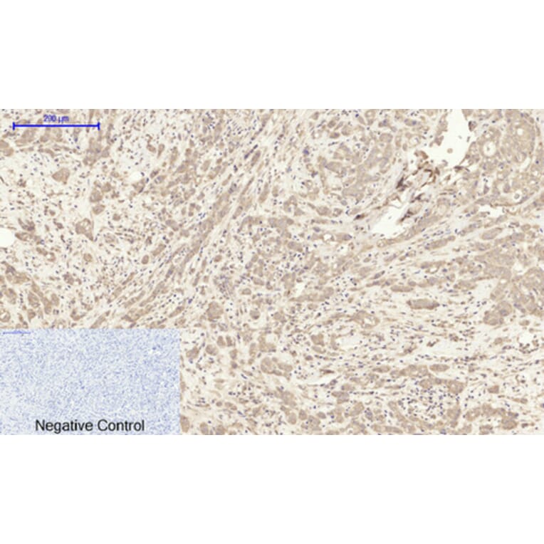 Immunohistochemistry - Anti-ITGB3 Antibody (C30370) - Antibodies.com