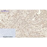 Immunohistochemistry - Anti-ITGB3 Antibody (C30370) - Antibodies.com