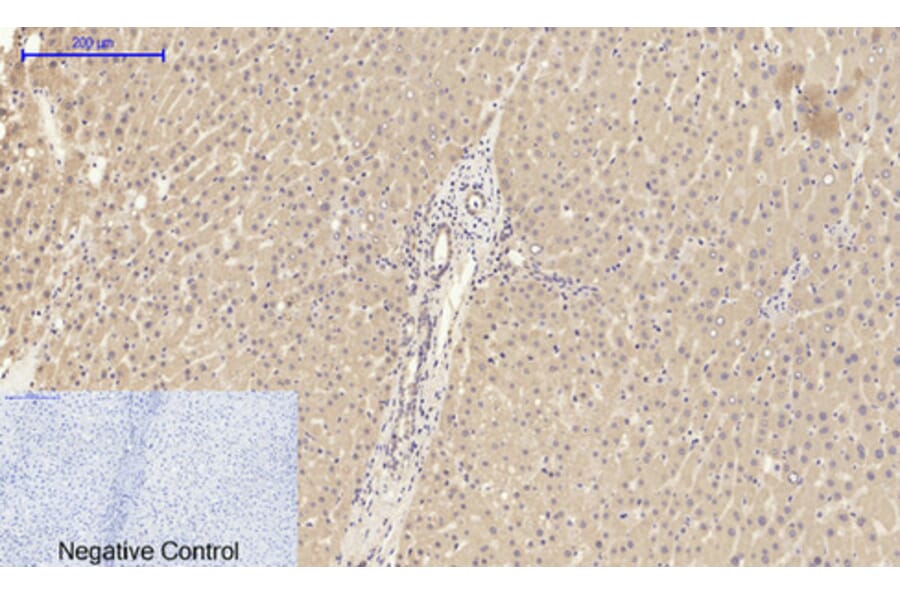 Immunohistochemistry - Anti-ITGB3 Antibody (C30370) - Antibodies.com