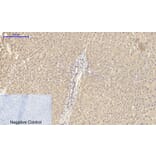 Immunohistochemistry - Anti-ITGB3 Antibody (C30370) - Antibodies.com