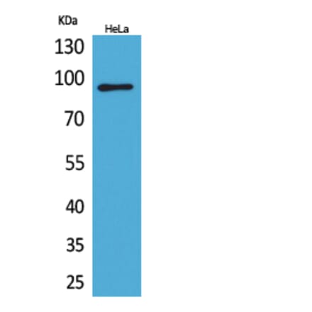 Western Blot - Anti-ITGB2 Antibody (C30332) - Antibodies.com