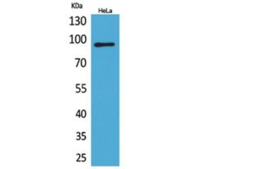 Western Blot - Anti-ITGB2 Antibody (C30332) - Antibodies.com