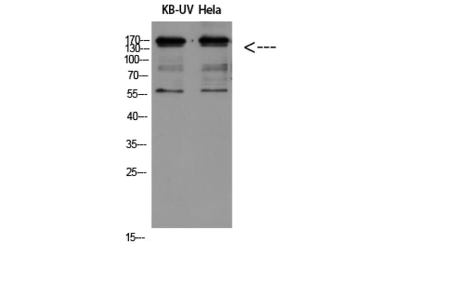 Western Blot - Anti-ITGB2 Antibody (C30332) - Antibodies.com