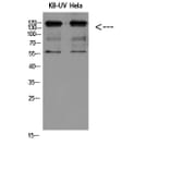 Western Blot - Anti-ITGB2 Antibody (C30332) - Antibodies.com