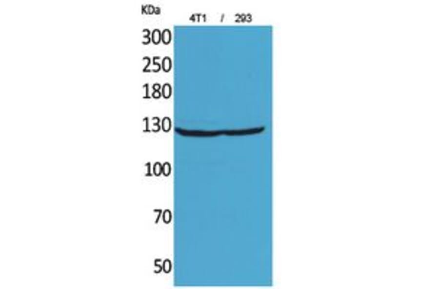 Western Blot - Anti-ITGAD Antibody (C30328) - Antibodies.com