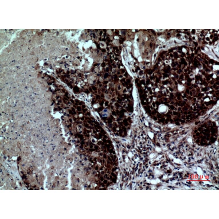 Immunohistochemistry - Anti-ITGAD Antibody (C30328) - Antibodies.com