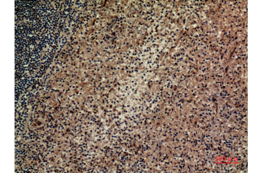 Immunohistochemistry - Anti-ITGAD Antibody (C30328) - Antibodies.com