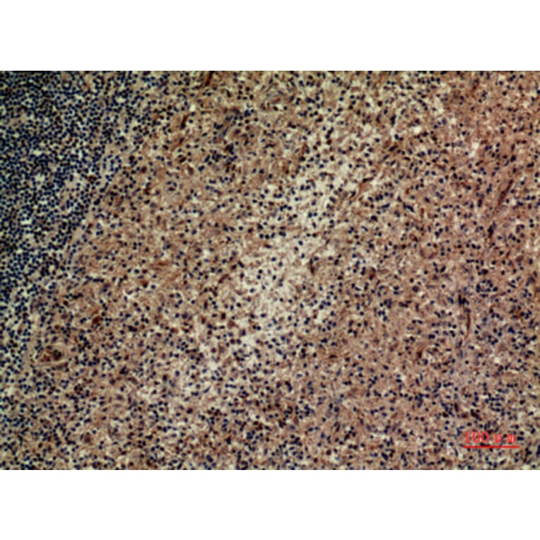 Immunohistochemistry - Anti-ITGAD Antibody (C30328) - Antibodies.com