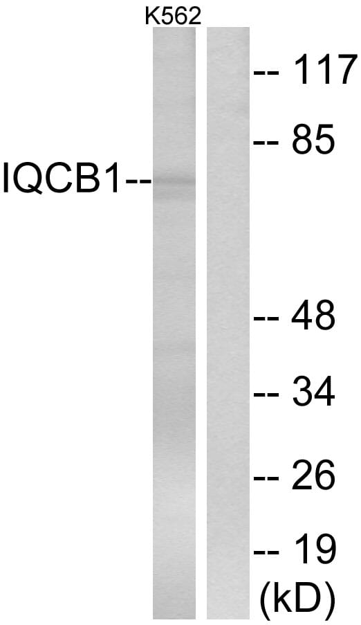 Western blot analysis of lysates from K562 cells using Anti-IQCB1 Antibody. The right hand lane represents a negative control, where the antibody is blocked by the immunising peptide.