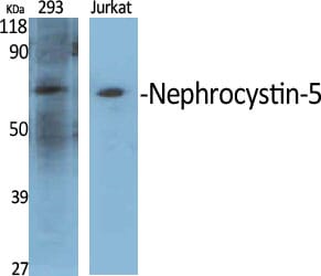 Western blot analysis of various cells using Anti-IQCB1 Antibody.