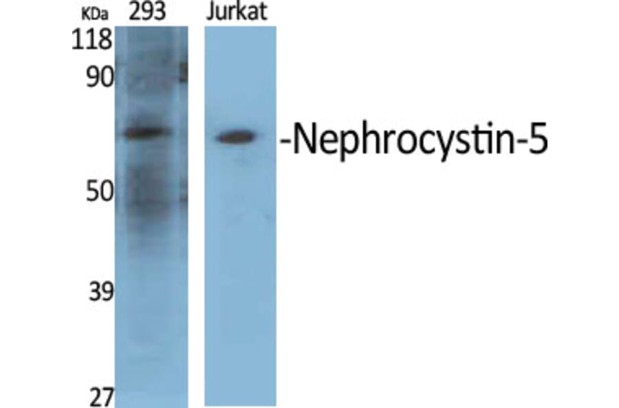 Western Blot - Anti-IQCB1 Antibody (C16402) - Antibodies.com