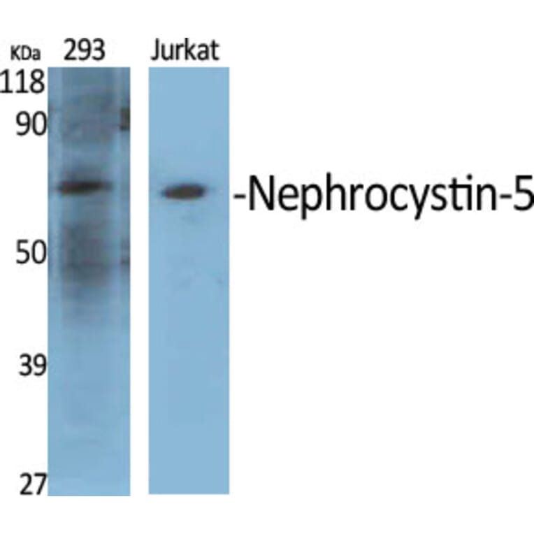 Western Blot - Anti-IQCB1 Antibody (C16402) - Antibodies.com