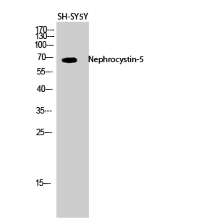 Western Blot - Anti-IQCB1 Antibody (C16402) - Antibodies.com