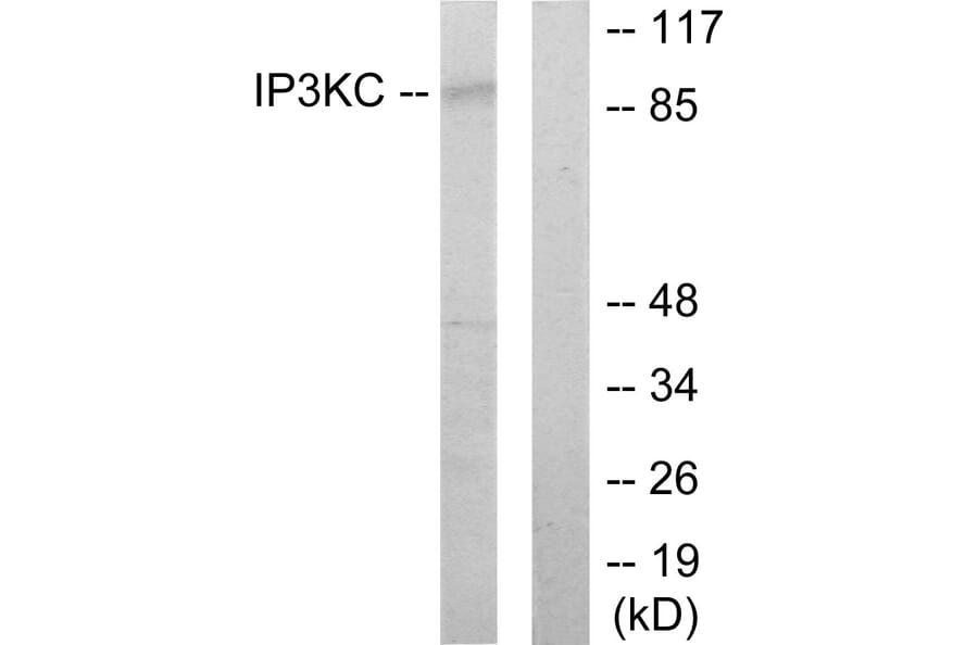 Western Blot - Anti-IP3KC Antibody (C11487) - Antibodies.com