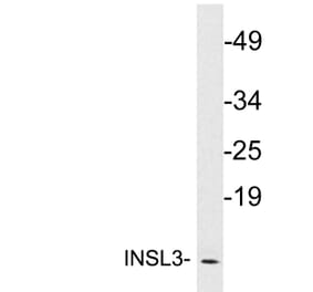 Western Blot - Anti-INSL3 Antibody (R12-2218) - Antibodies.com