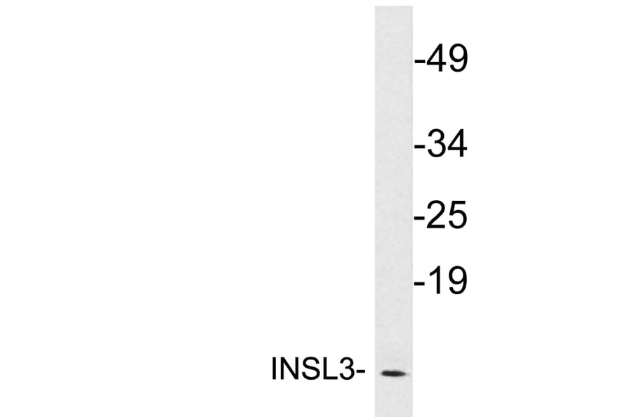 Western Blot - Anti-INSL3 Antibody (R12-2218) - Antibodies.com