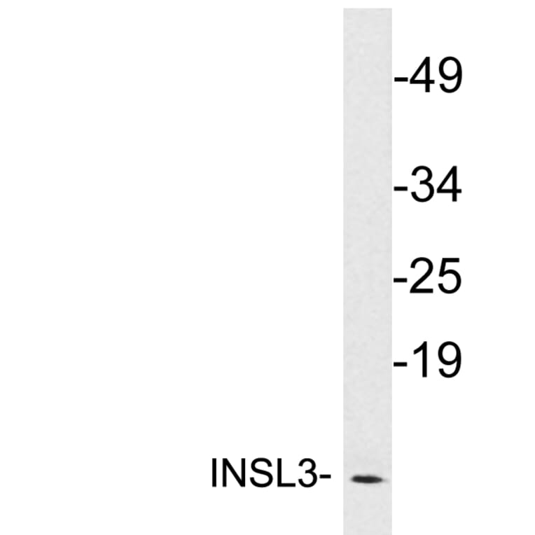 Western Blot - Anti-INSL3 Antibody (R12-2218) - Antibodies.com