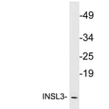 Western Blot - Anti-INSL3 Antibody (R12-2218) - Antibodies.com