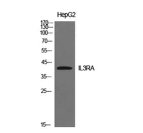 Western Blot - Anti-IL3RA Antibody (C30233) - Antibodies.com