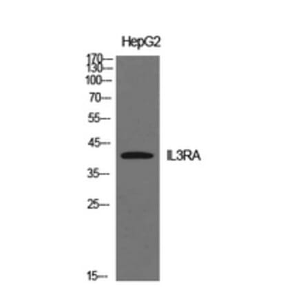Western Blot - Anti-IL3RA Antibody (C30233) - Antibodies.com
