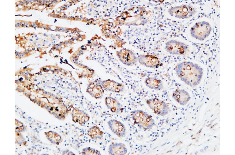 Immunohistochemistry - Anti-IL3RA Antibody (C30233) - Antibodies.com