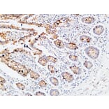 Immunohistochemistry - Anti-IL3RA Antibody (C30233) - Antibodies.com