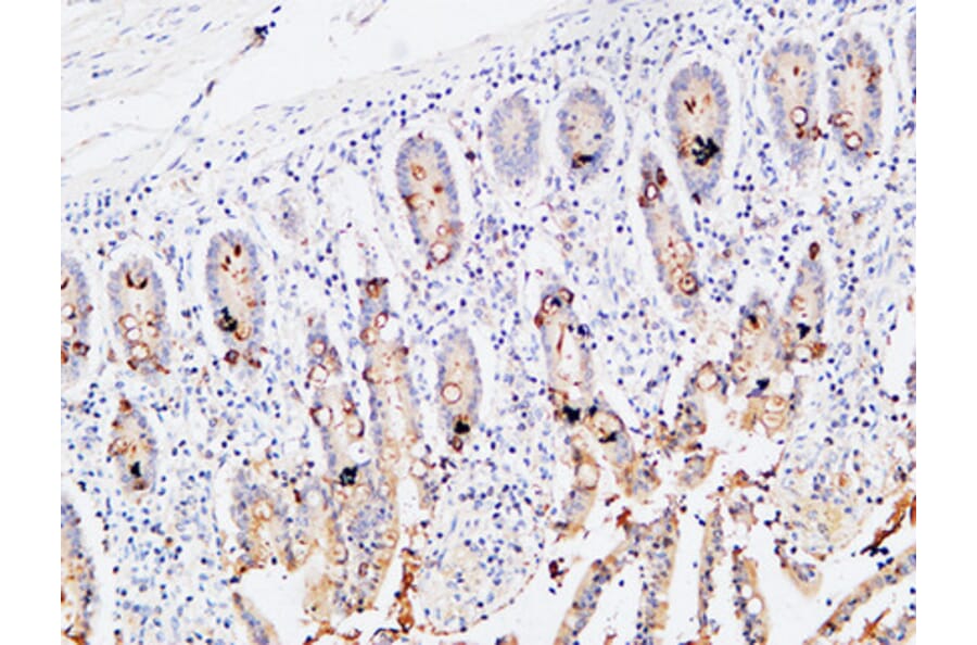 Immunohistochemistry - Anti-IL3RA Antibody (C30233) - Antibodies.com