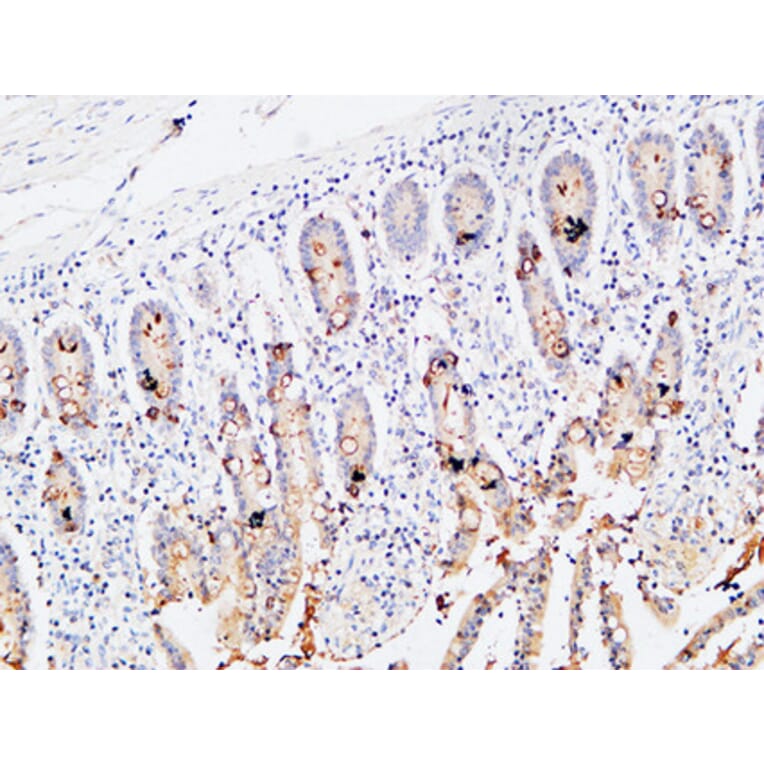 Immunohistochemistry - Anti-IL3RA Antibody (C30233) - Antibodies.com